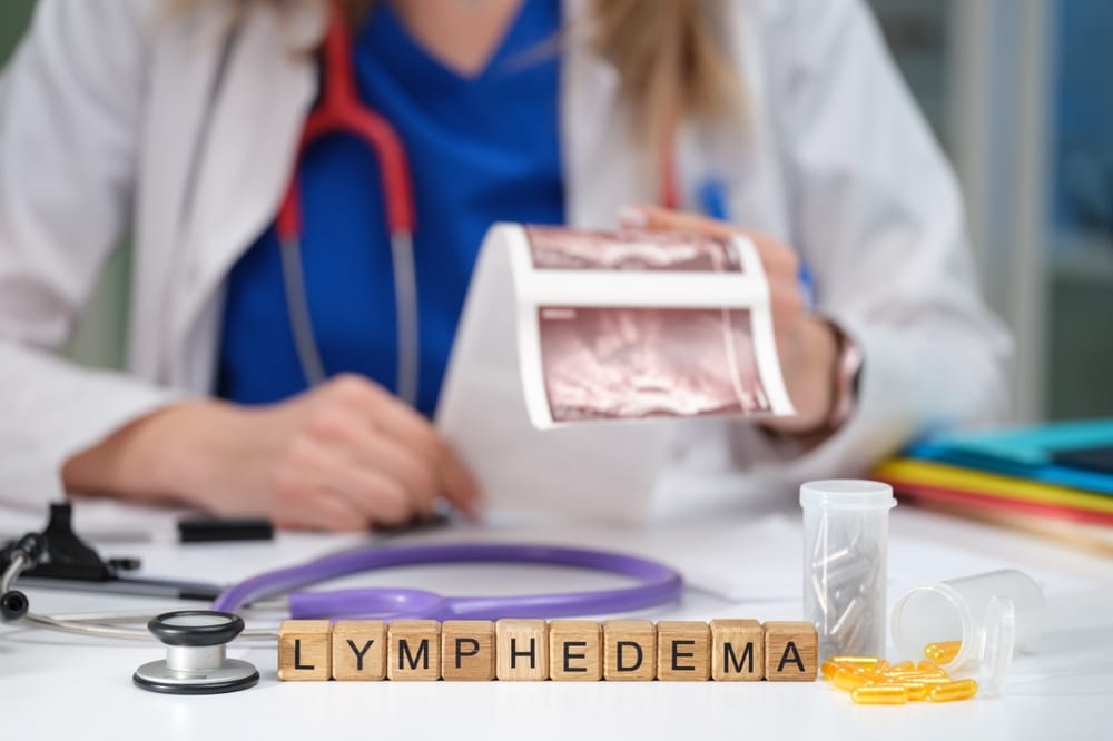 Lymphödeme verstehen und behandeln